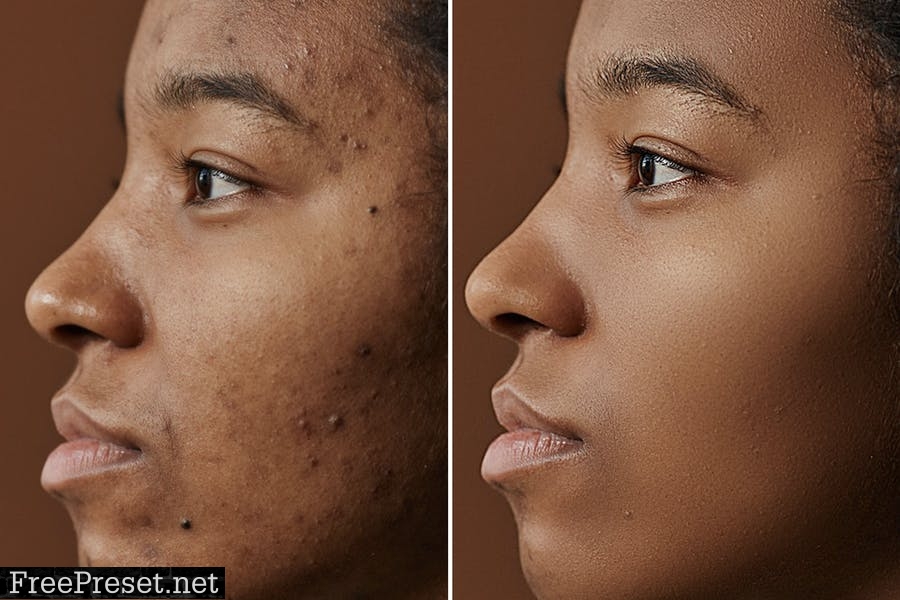 High-End Smooth Skin Retouch Photoshop Action